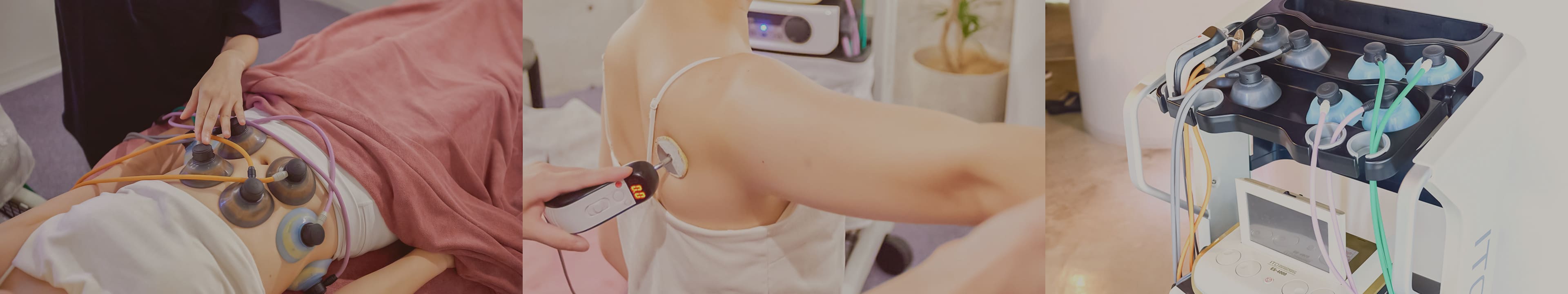 ハイボルト治療（四ツ橋店限定）