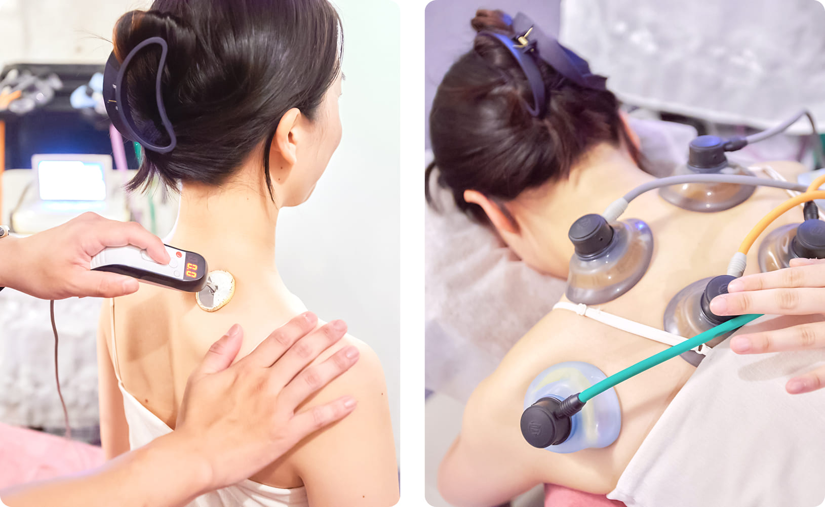 ハイボルト治療（四ツ橋店限定）