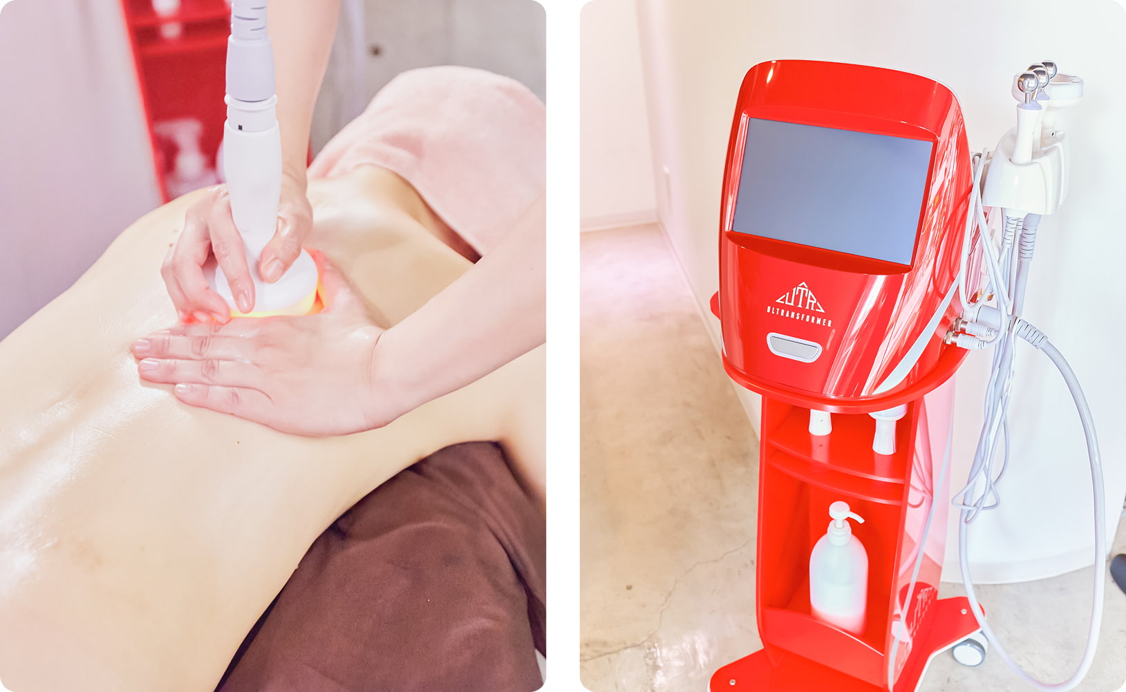 筋膜リリーストリートメント